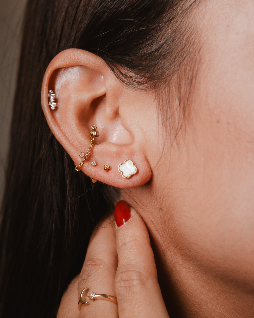 Arete VC